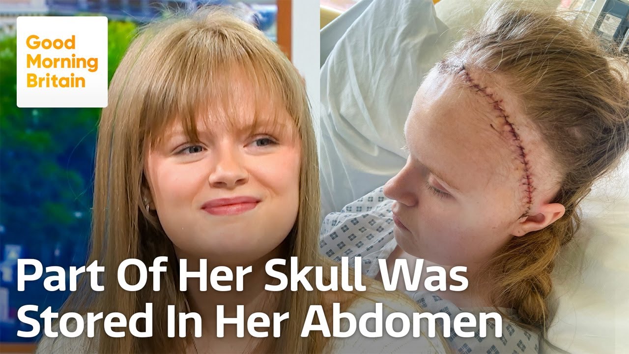 The Miracle Operation That Allowed Me to Walk and Talk Again!