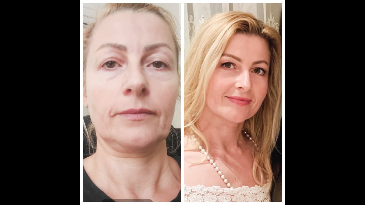Comment lutter contre les bajoues? mes résultats:)