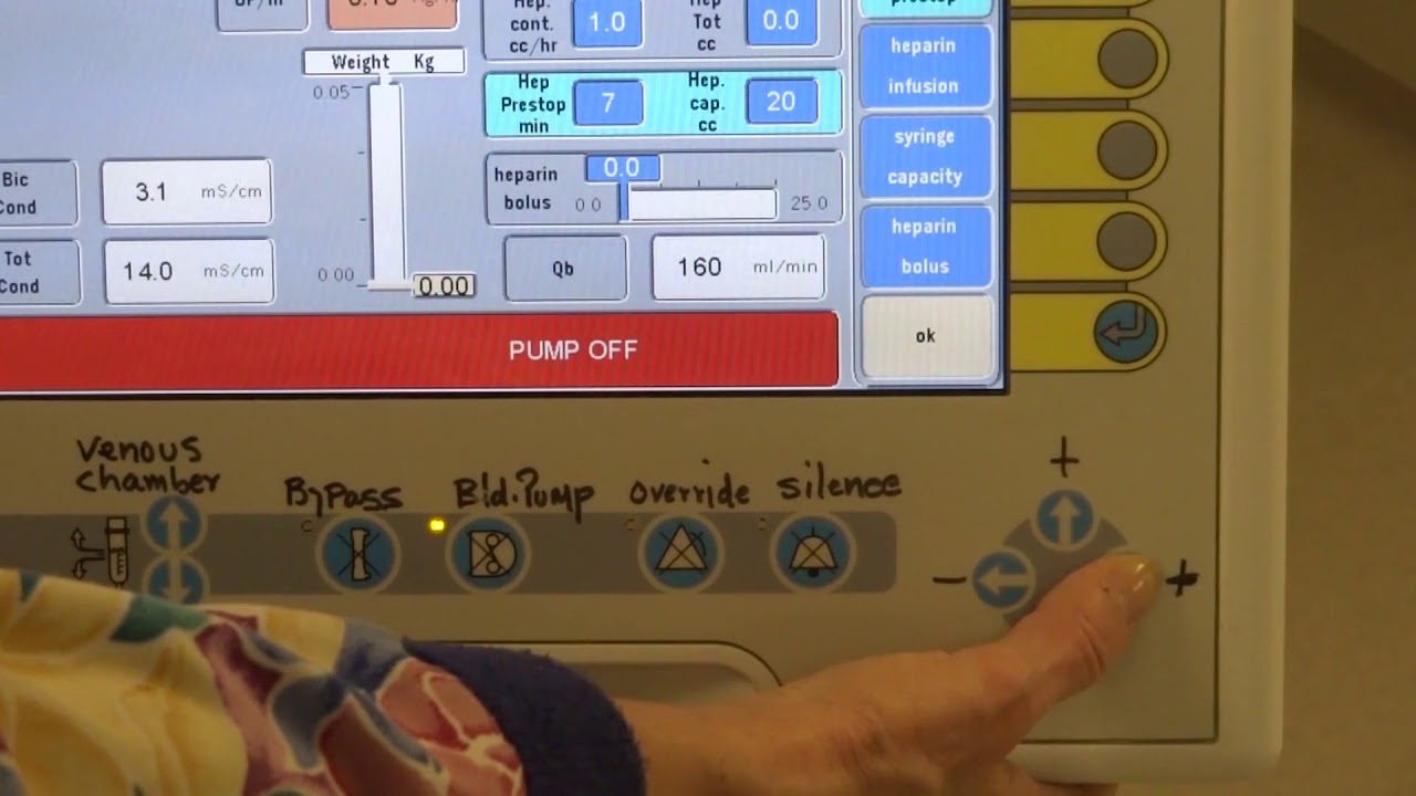 08 UHN Home Hemodialysis Setup Parameters