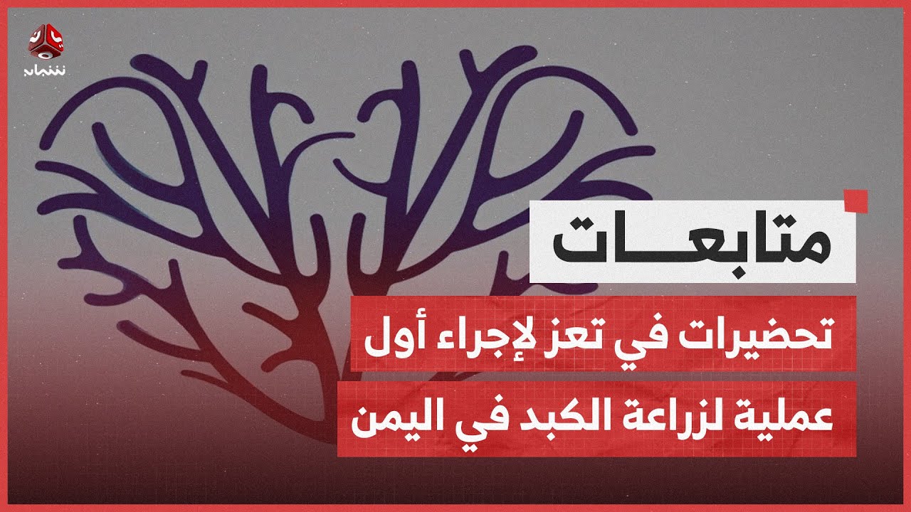 تحضيرات في تعز لإجراء أول عملية لزراعة الكبد في اليمن