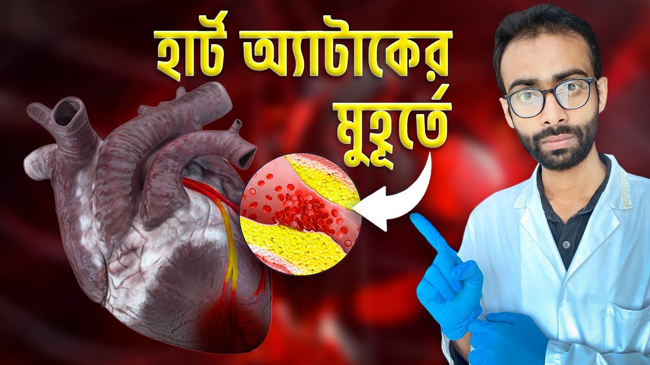 হার্ট অ্যাটাক বাড়ছে যেকারণে- বাঁচার উপায় কি? । Sabbir Ahmed