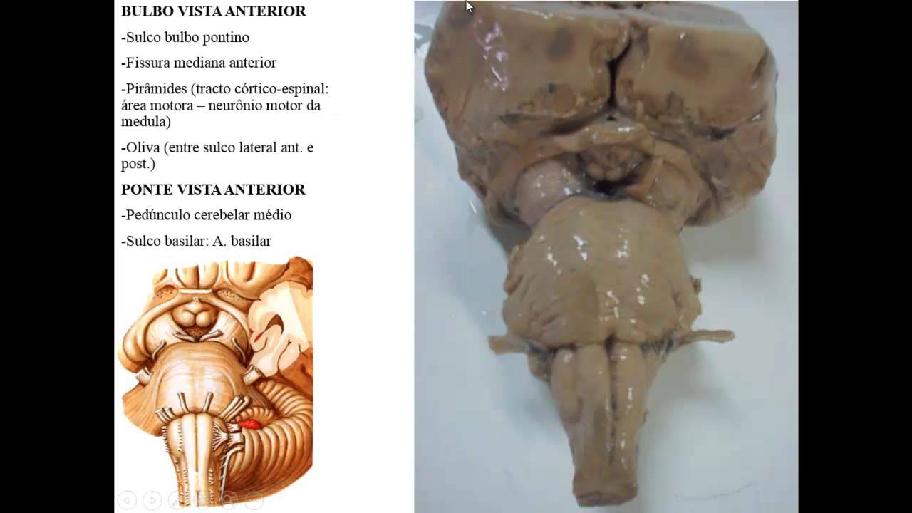 ANATOMIA MACROSCÓPICA DO SNC PARTE 1 - TRONCO ENCEFÁLICO