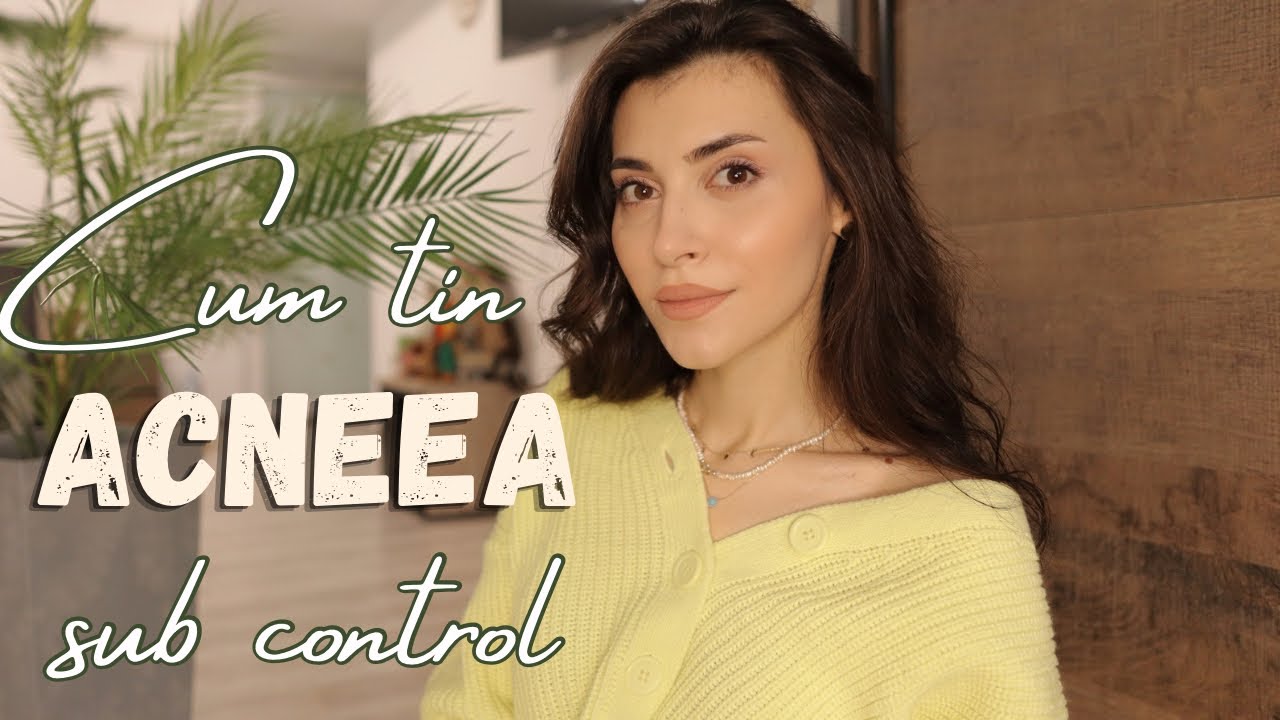 Cum am scapat de acnee si cum o tin sub control ✨
