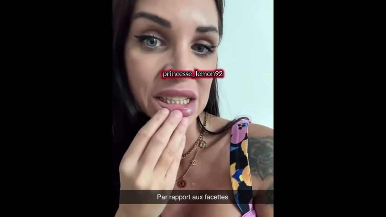 Julia Paredes parle de ses dents