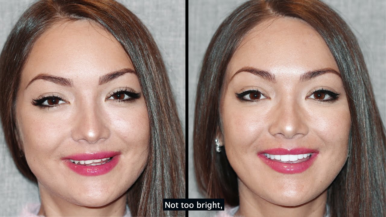 Composite Bonding Smile Makeover with Dr Emanuel Layliev | New York Center for Cosmetic Dentistry