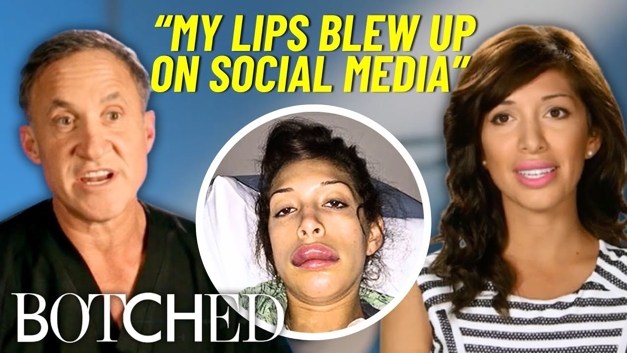 ОТВЕРГНУТО компанией Botched: Кошмар звезды MTV Teen Mom Фарры Абрахам с филлером для губ | Botch...