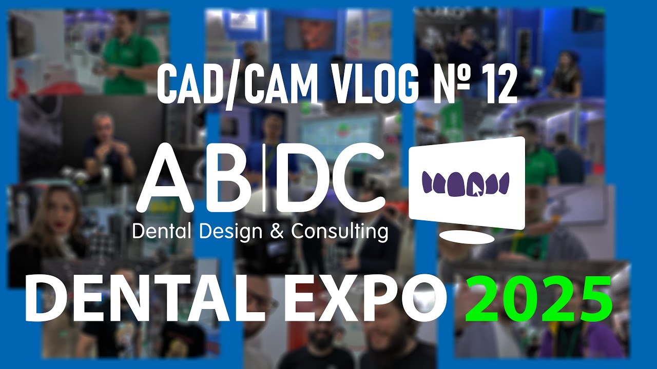CAD/CAM VLOG 12: DENTALEXPO 2025 - NAVIDENT, MIS, Dentalbox, Habilect, SAM, Pretor, SDI MATRIX