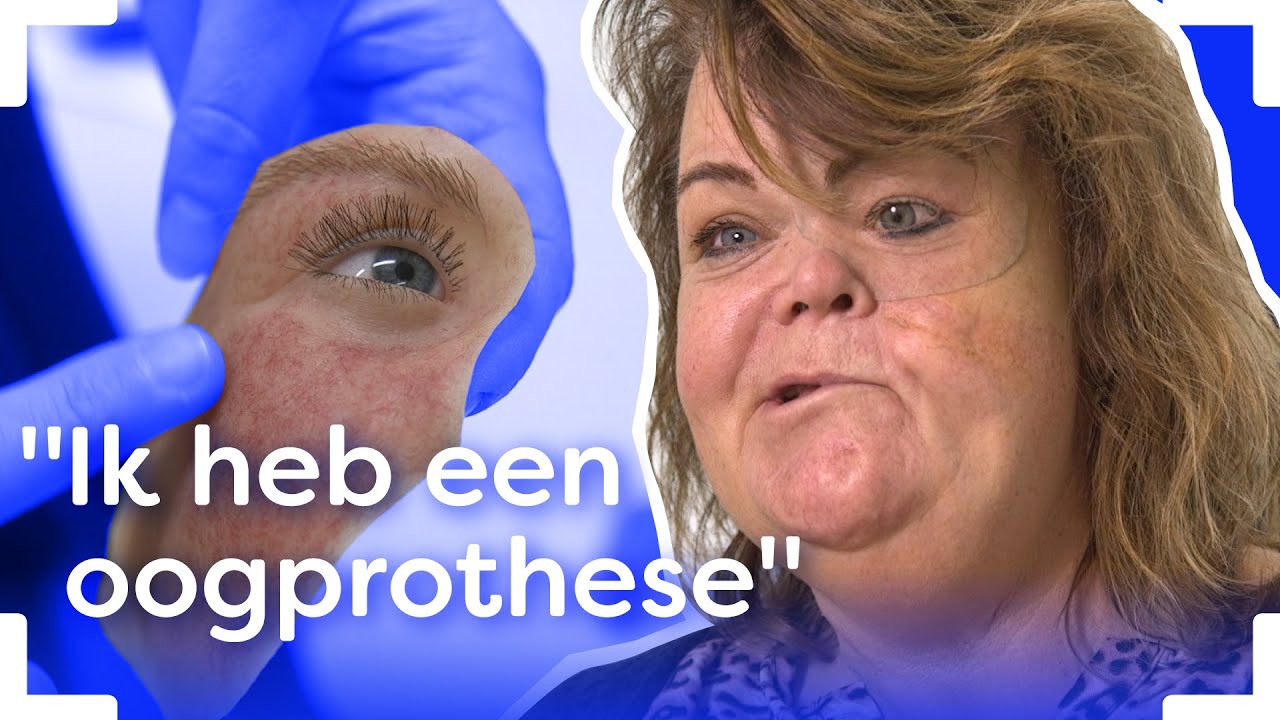 Van gips naar oog | Mijn Missie | Brandpunt+