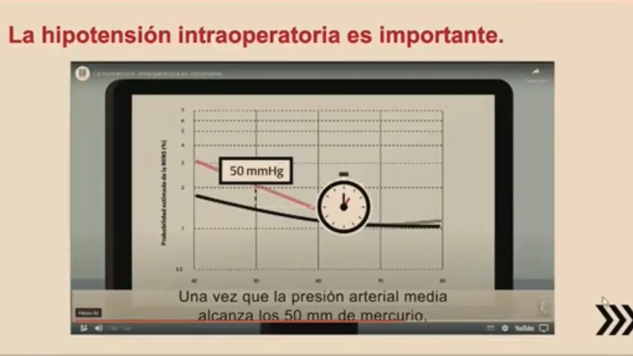 Hipotensión intraoperatoria: ¿Podemos prevenirla con inteligencia artificial? - Dr. Germán Gómez
