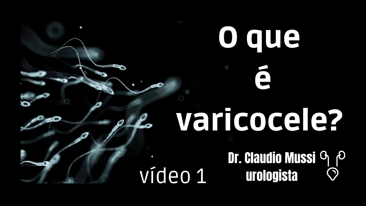 O que é varicocele?