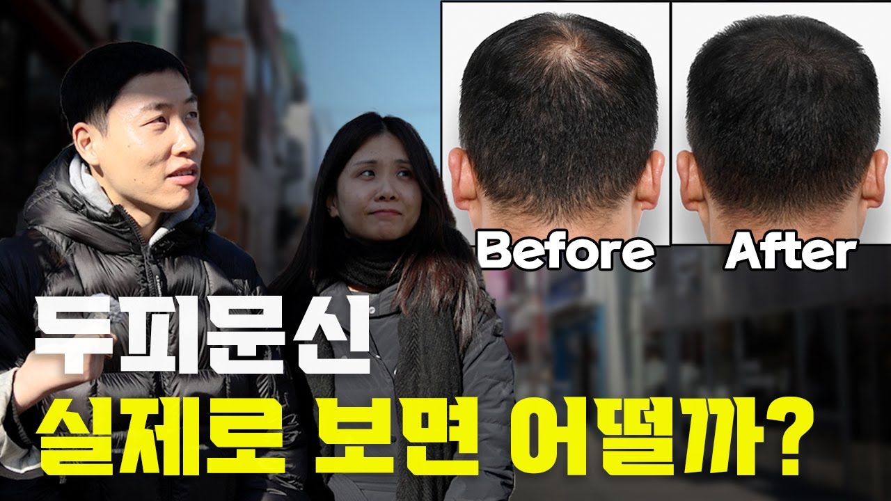두피문신 실제 길거리 반응! (실제로 보면 어떨까? 내가 받으면 어떨까?)