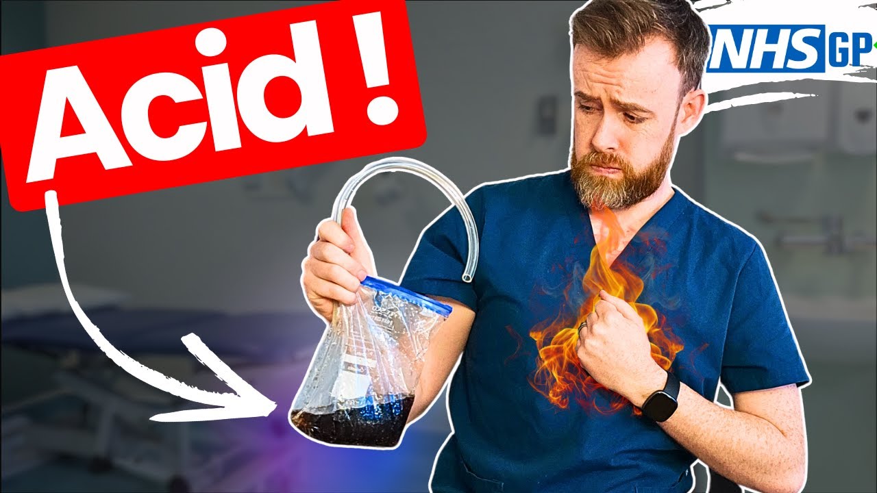 Изжога: проще некуда!... от врача, который сам от нее страдает🔥