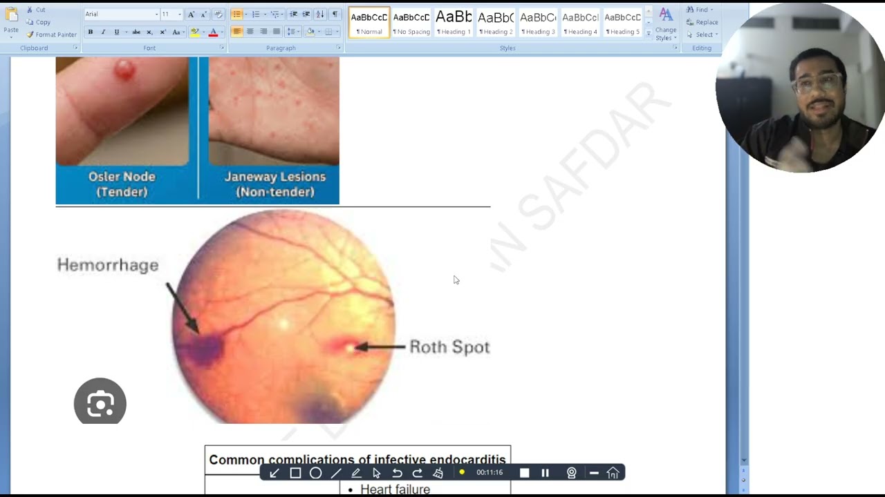 Cardiovascular System Masterclas Step 2ck part 2