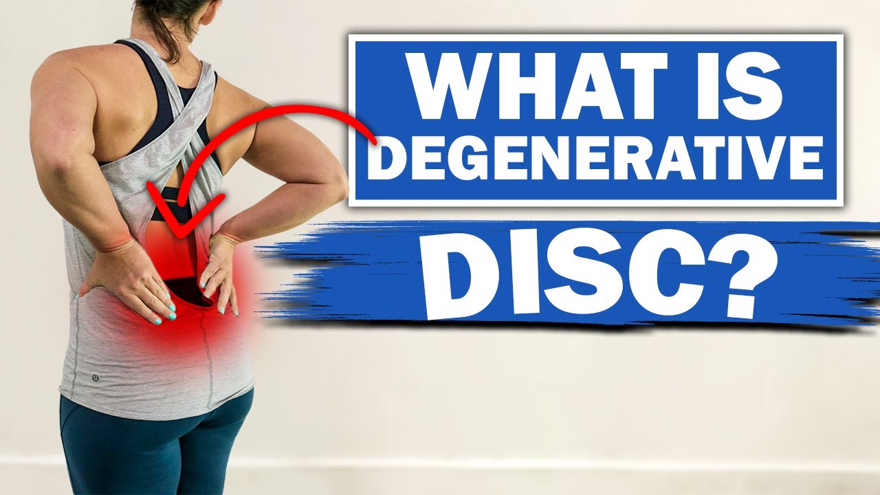Degenerative Disc Disease [Exercises & Diagnosis]