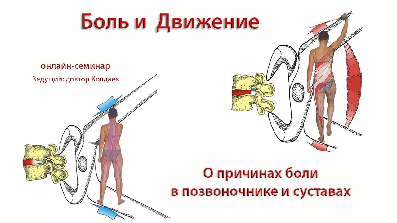 Боль и движение