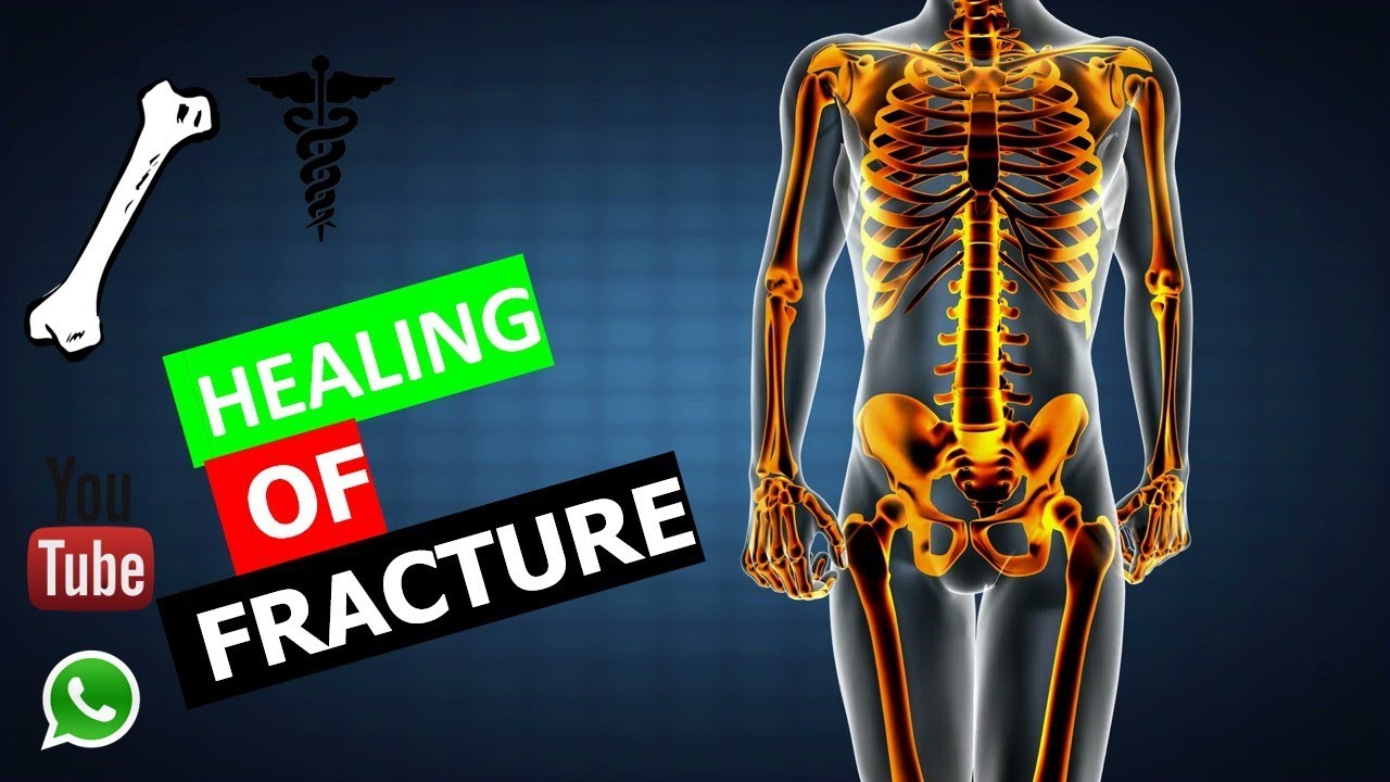 Orthopedics - Healing Of a Fracture |FMGE/NEET-PG|