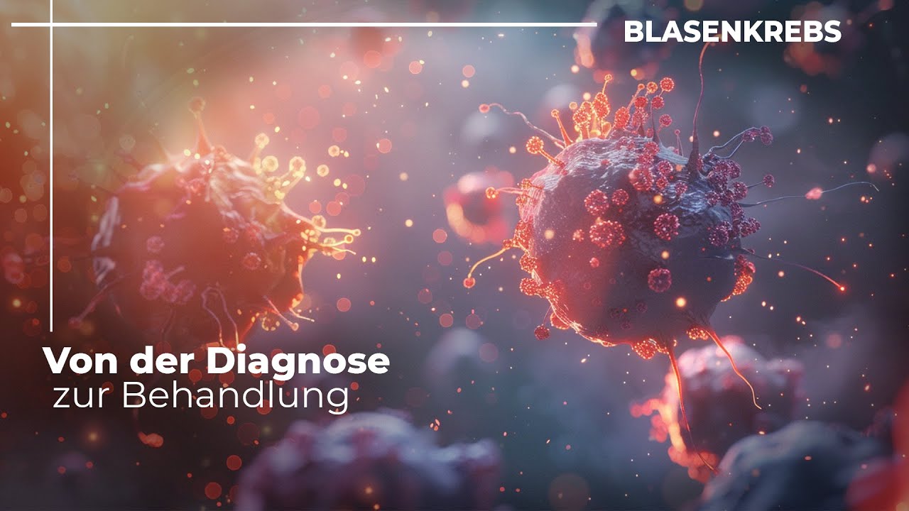 Blasenkrebs erkl&auml;rt: Symptome, Risiken und hoffnungsvolle Behandlungen