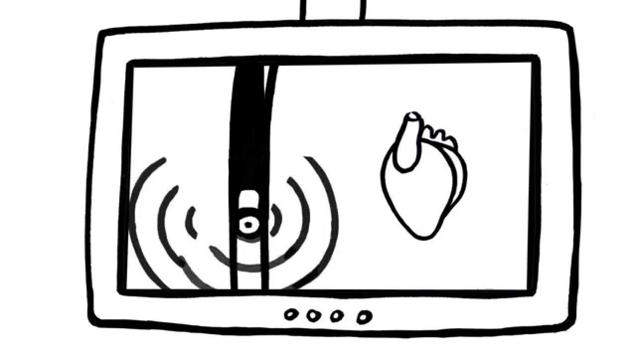 Slokdarm-echo-cardiografie - Ziekenhuis Gelderse Vallei