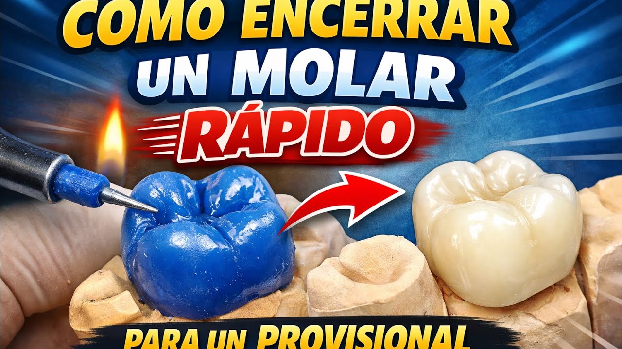 No sabes cómo encerar para un provisional rápido y fácil ? Aquí te doy una pequeña guía 