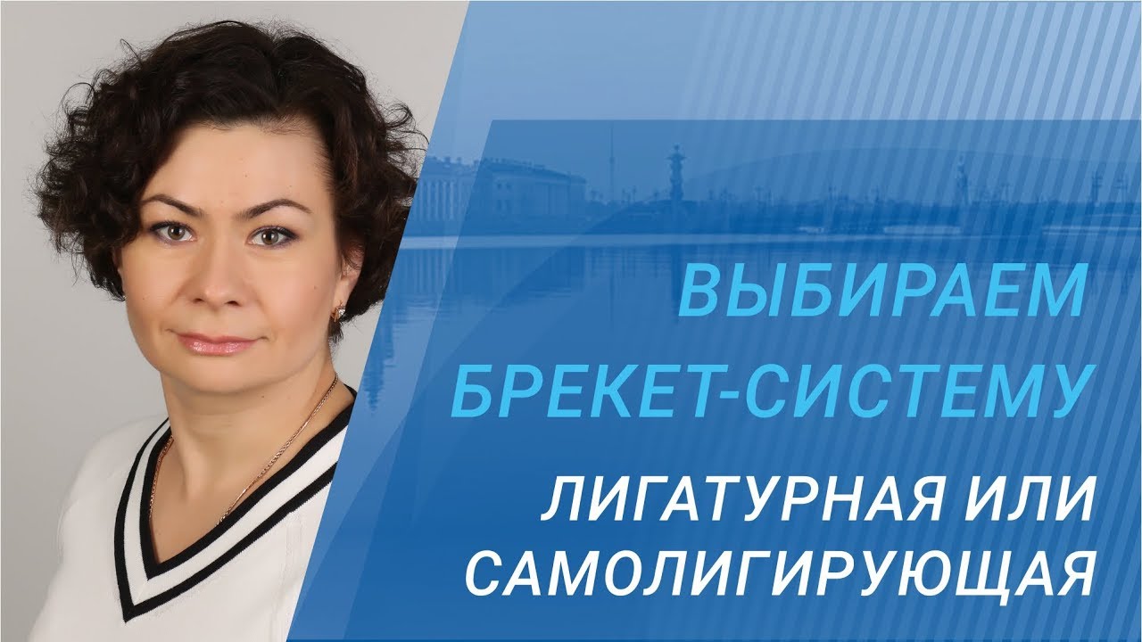 Выбираем брекет-систему. ЛИГАТУРНАЯ ИЛИ САМОЛИГИРУЮЩАЯ.