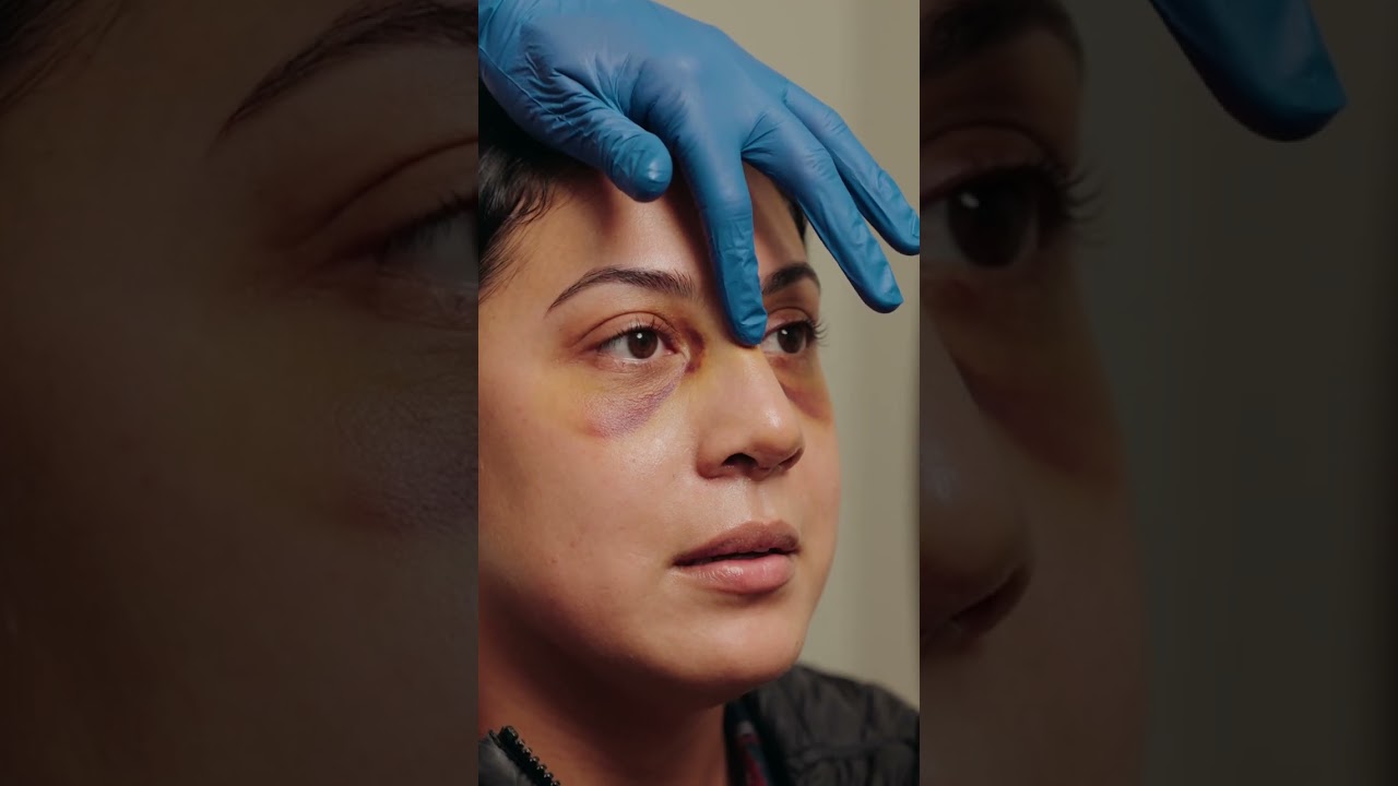 Cast Reveal & Results! ⏰👃🏼❤️‍🩹