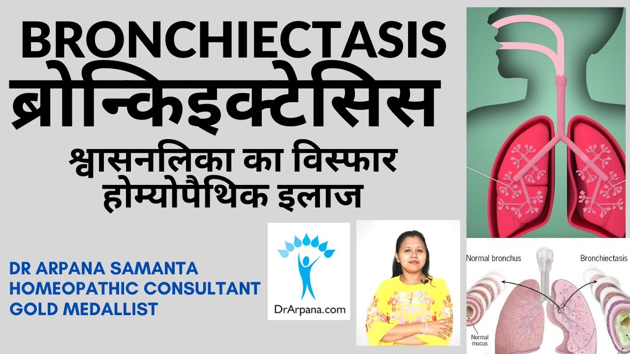 ब्रोन्किइक्टेसिस श्वासनलिका का विस्फार होम्योपैथिक इलाज | BRONCHIECTASIS Causes Symptoms Homeopathy