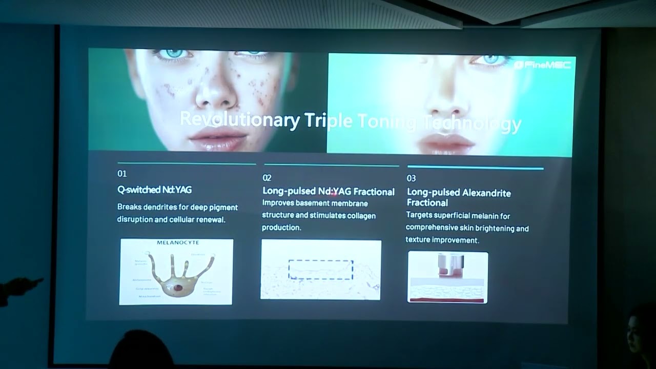Nobleen Dual Long Pulsed Nd:YAG & Alexandrite Laser (1064nm/755nm) Products & Clinics