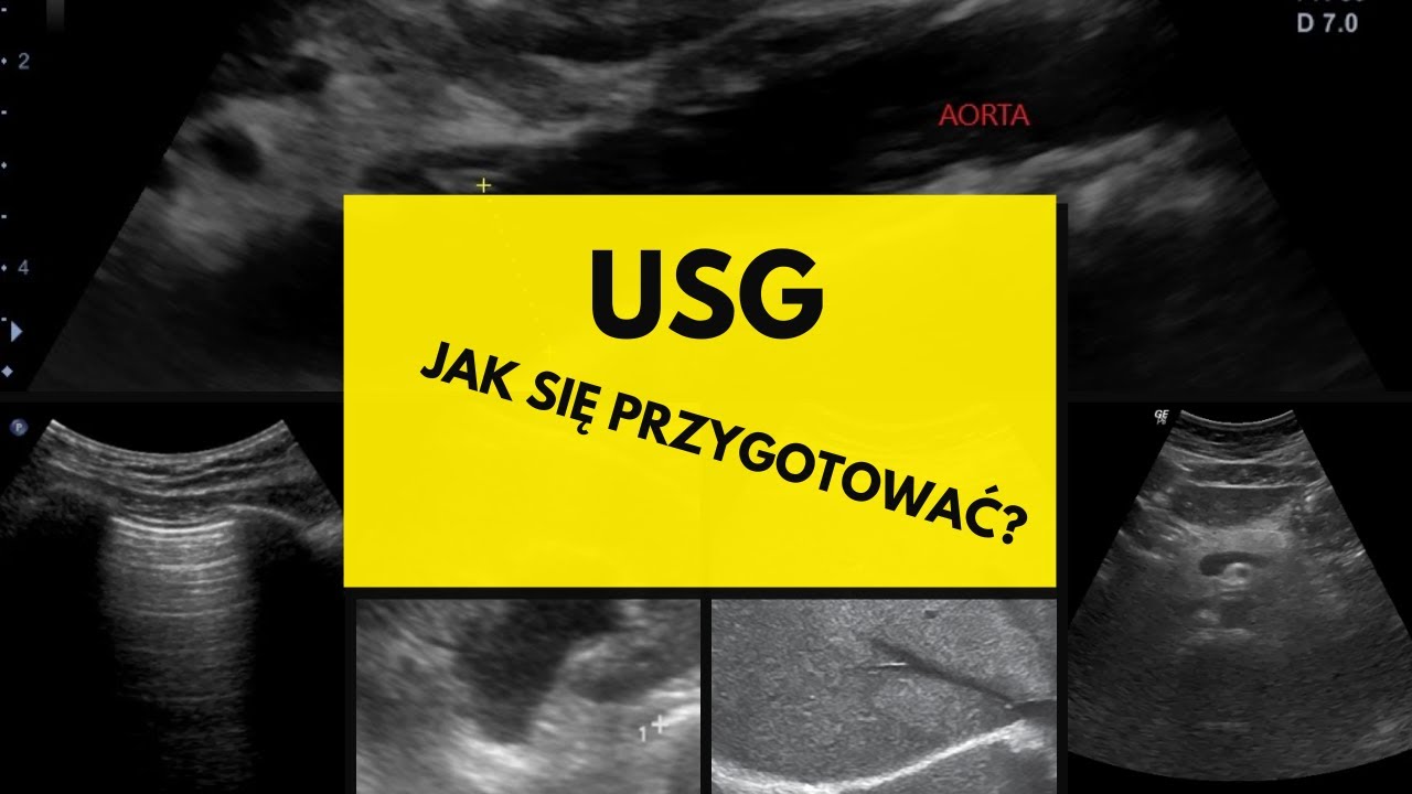 Lekarz: Jak przygotować się do USG brzucha?