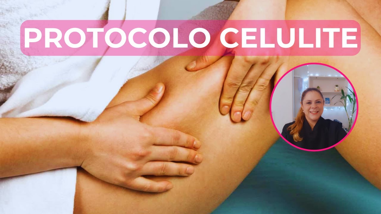 PROTOCOLO PARA CELULITE
