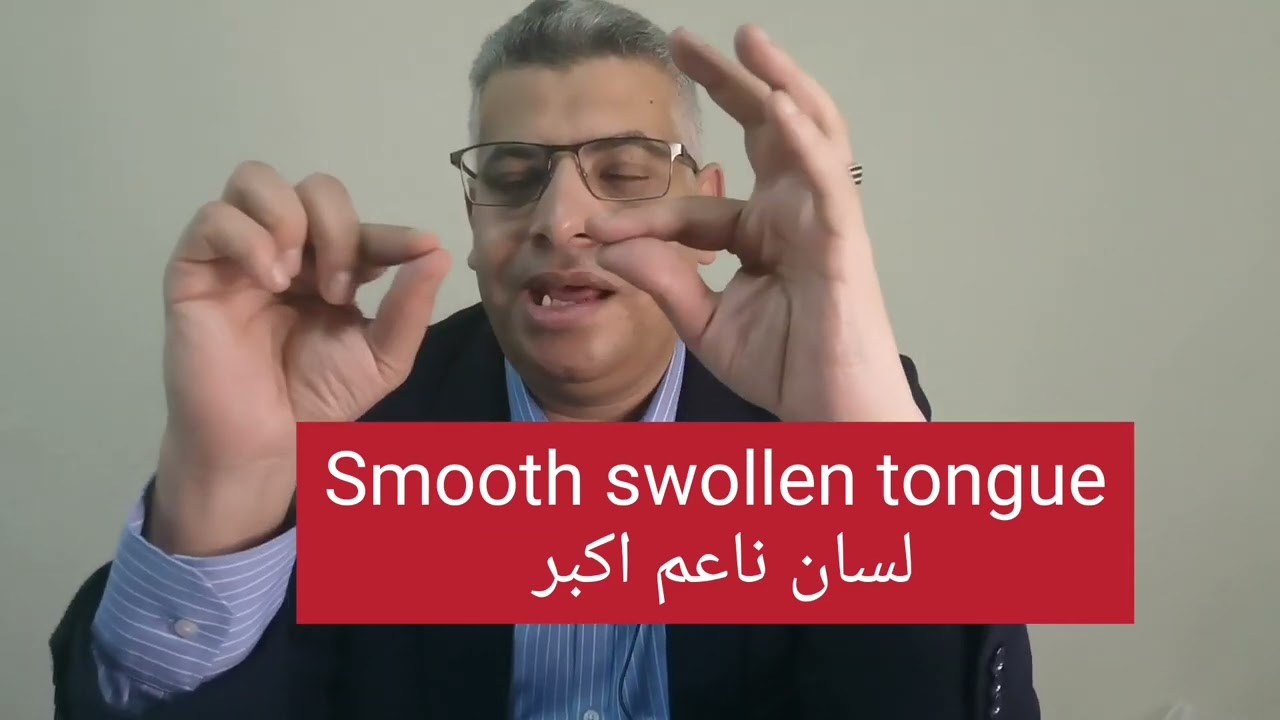 ٧ علامات تعرف منهم ان عندك نقص فيتامين B12