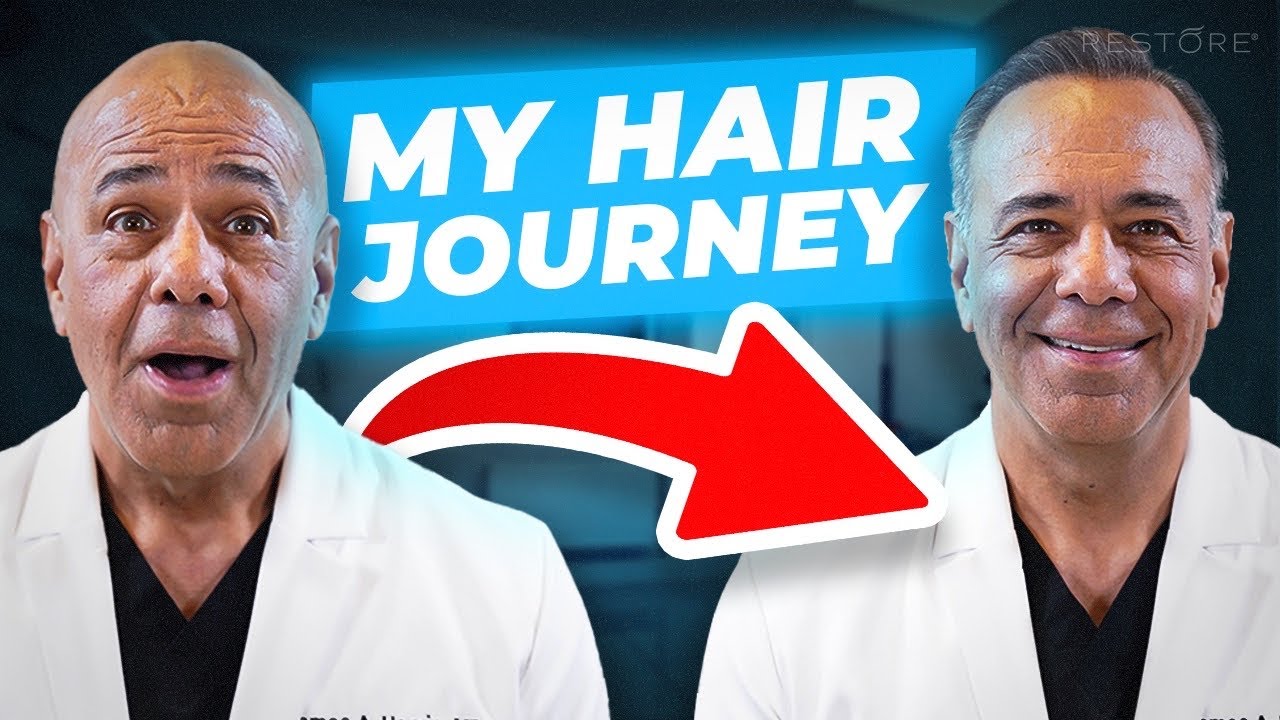 Dr Jim Harris Gives His Hair Restoration Story
