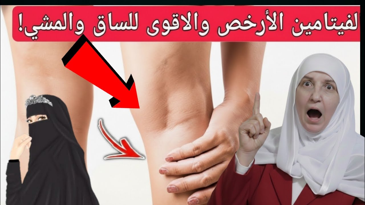 أفضل فيتامين للمشي بعد الستين او السبعين/ فيتامين يقوي الساقين يمنع الجلطات