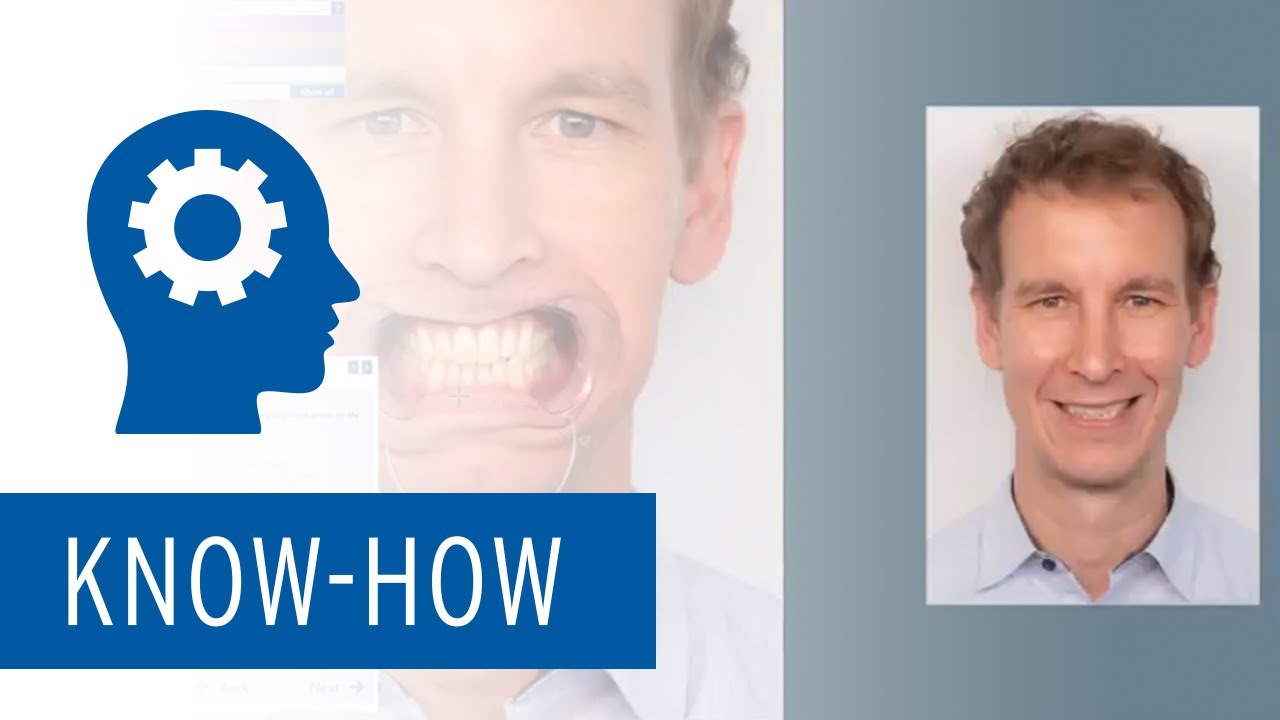 Ceramill M-Smile Software Module  - Esthetic planning in the dental laboratory