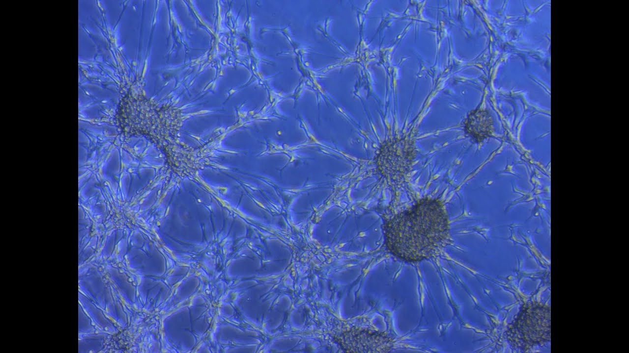 Exosome Isolation from Cell Culture Media- CBEC Cell Block