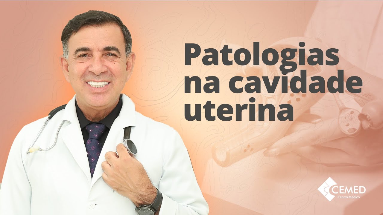 Patologias na Cavidade Uterina