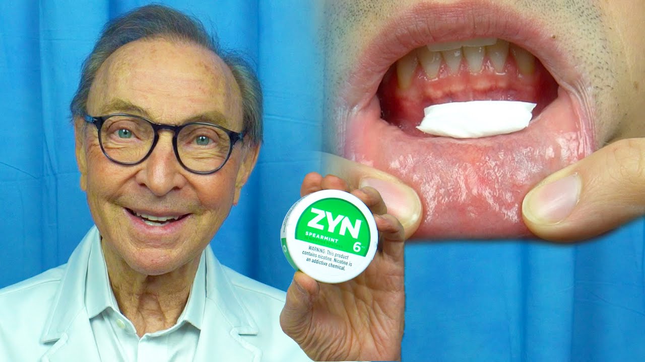ZYN — риски и преимущества для здоровья полости рта! Обзор доктора Немета