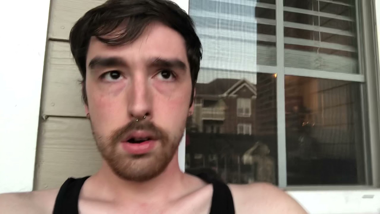 Vaping After Wisdom Teeth Removal