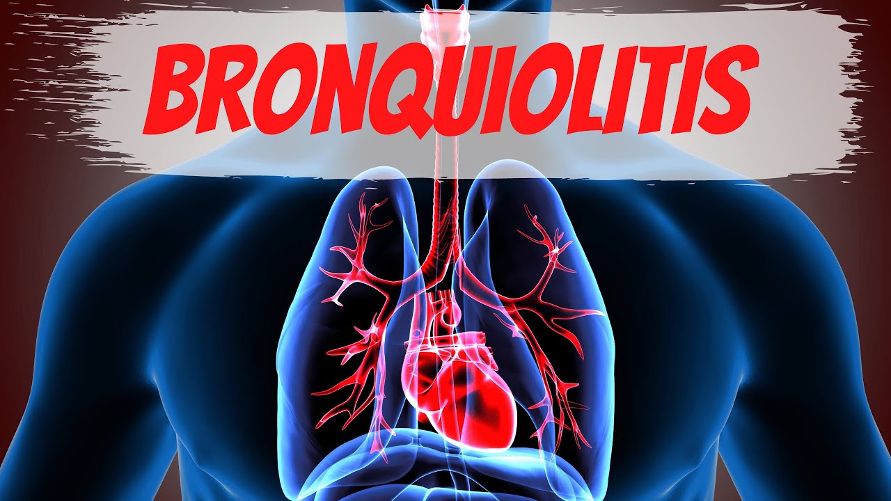 Bronquiolitis en el Adulto