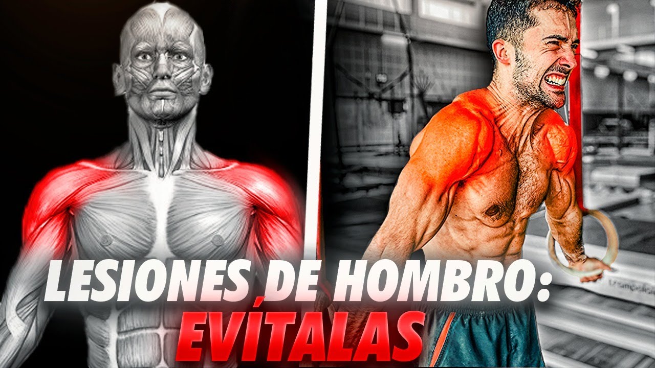 EJERCICIOS para EVITAR LESIONES DE HOMBROS en CALISTENIA - GYMNASTICS🔥