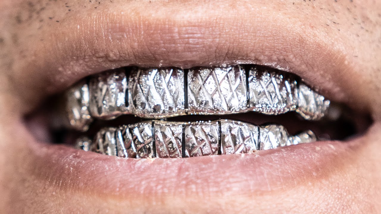 CUSTOM GOLD GRILLZ | WHAT YOU NEED TO KNOW