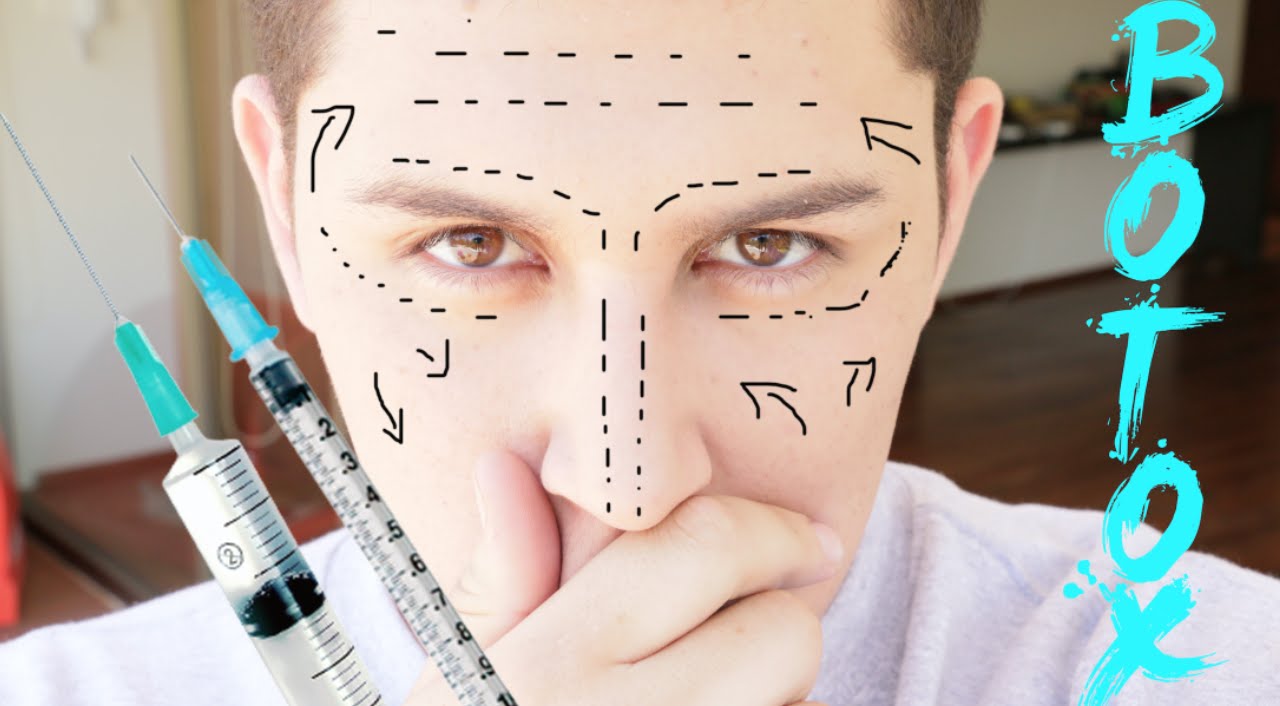 El BOTOX Aplicación en vivo! / Quitar arrugas Rapido! @Lordmoshe @ javierderma