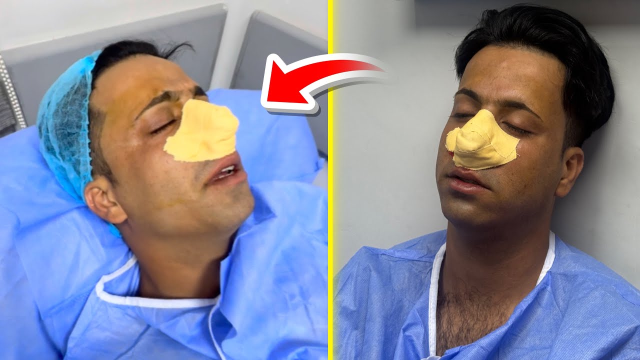 عملية جاسم | اثار البنج تحشيش 🤣