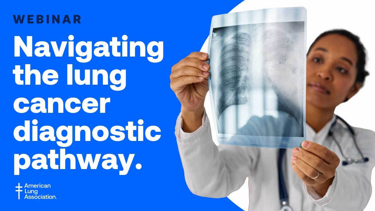 From Detection to Decision: Navigating the Lung Cancer Diagnostic Pathway