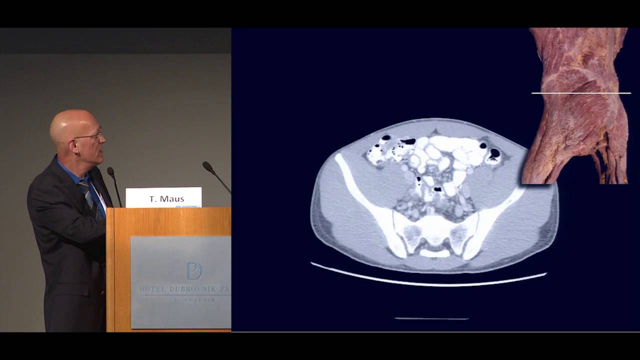 The Sacroiliac Joint