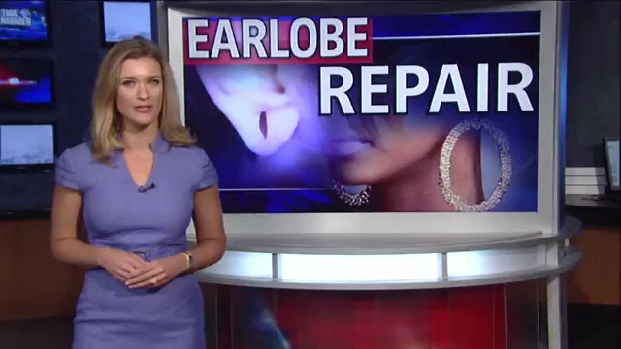 Earlobe Repair in Houston TX