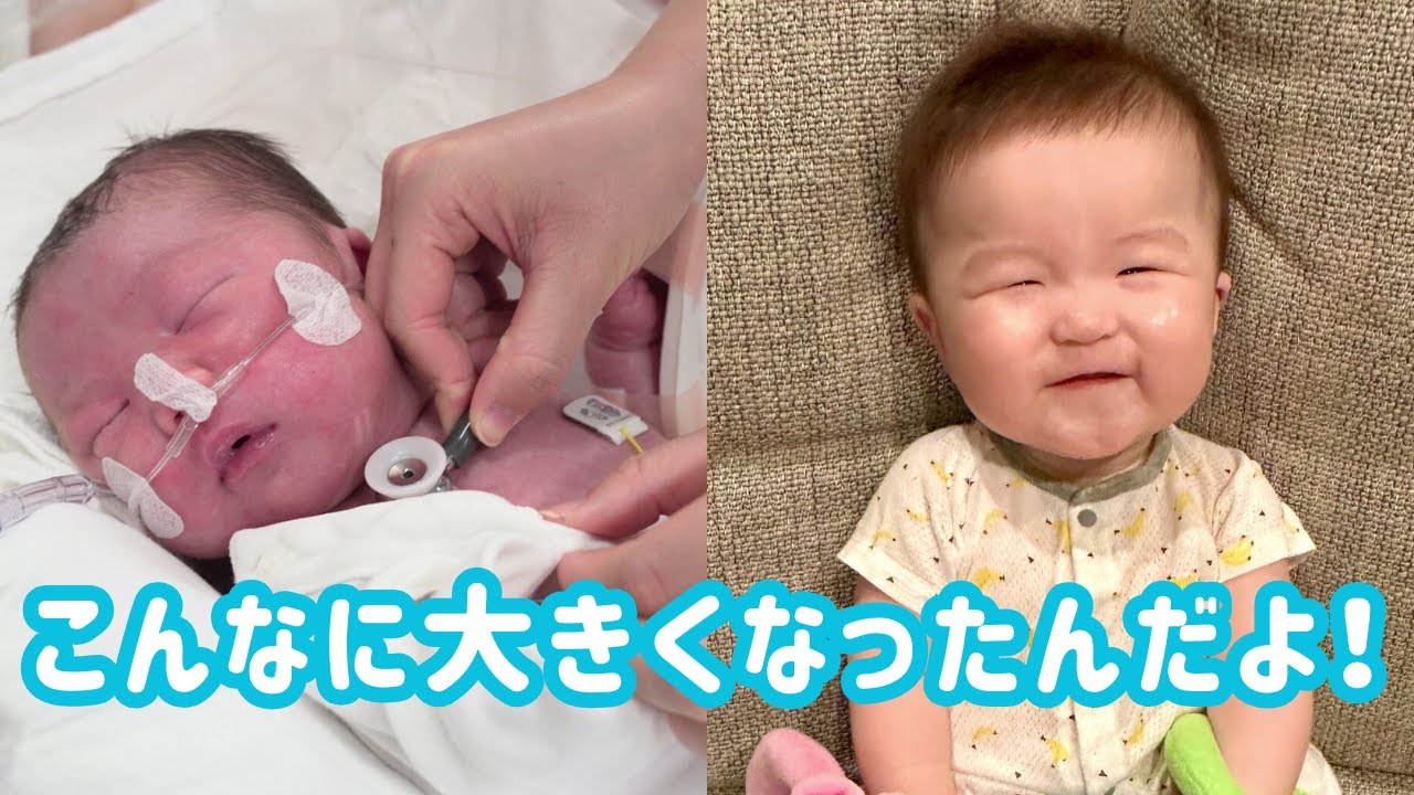 【医者もびっくり】脳の病気なんて関係ない！10ヶ月ベビー奇跡の成長記録