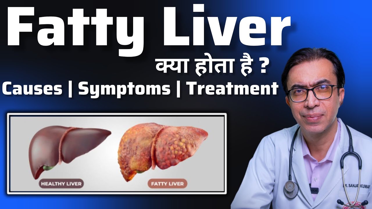 Fatty Liver: Causes, Symptoms, and Treatment | क्या होता है फैटी लिवर और इसका इलाज कैसे किया जाता है