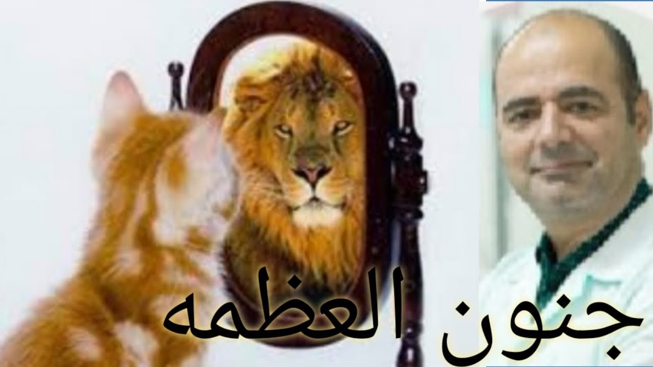 Paranoid personality جنون العظمه #جنون_العظمه#بارانويا#الشخصية_الزوريه  #paranoid_personality