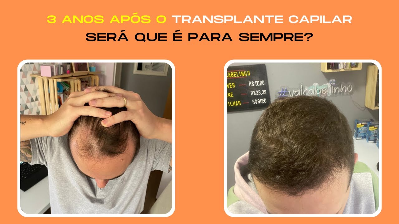 Transformação Capilar em 3 Anos: Descubra os Segredos do Meu Sucesso!