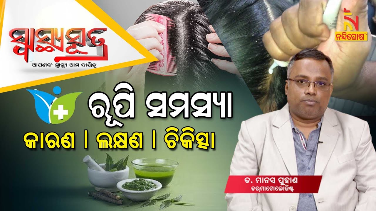 SWASTHYA SUTRA | What Is The Main Reason For Dandruff ? Treatment & Dermatology Hacks |NandighoshaTV